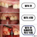 바로세움치과 이미지