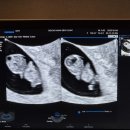 서초하나산부인과의원 이미지