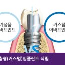 청도치과기공소 네이버블로그