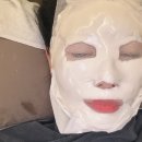 엑스디테일 | 방배동피부과 실펌엑스 후기/모공·탄력&amp;색소 자국없이👍🏻