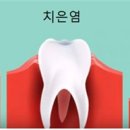미플란트치과 이미지