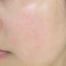 하단본약국 | 리쥬비넥스크림 그렇게 좋아? PDRN 효능 약국 가격 효과 솔직 후기