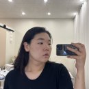 청아 에스테틱 | 중랑구 에스테틱 청아온결 아쿠아필 피부관리 후기