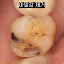 내이처럼기공소 이미지