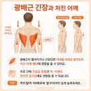 강남구청 필라테스 무겁고 뻐근한 목 어깨통증원인 타파하는 처진어깨 테스트 및 어깨 통증 운동 방법
