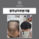 한올가발 | 가성비 + 품질 다 잡은 광주남자부분가발 솔직 후기