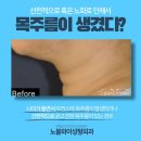 노블성형외과의원 이미지