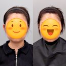 김포 구래동 온다리프팅 무통증 이중턱 심술보 라인 정리 후기