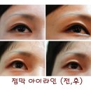 아띠애