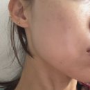 에스테틱윤 | 마곡윤곽관리 맛집 윤에스테틱 후기