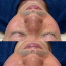 라라샵 검단점 | 김포 검단 신부관리 어디서? 예민피부도 편안했던 비비드엘 인천점 체험기