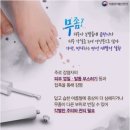 개발바닥 | 발바닥 무좀 병원 가기 전에 이거 먼저 보셈;;