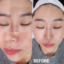 천안피부관리추천! 불당동 슈가홀릭 크라이오더마플래닝 후기
