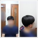 자산동198 | 꼼꼼히 선택해본 대구항암가발