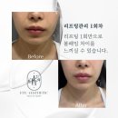 정성약국 | 논현동피부관리 에떼에스테틱 위치.가격.시간.후기