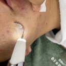 순천피부관리 순천여드름관리맛집 &#39;예쁘제이뷰티&#39;후기