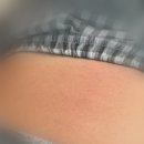 아이앤스타일 | 서울아이앤 시험관 병원 선택 이유 &amp; 과배란 주사 시작💉