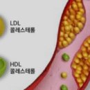 콜레스테롤 정상수치 4가지 정리 이미지