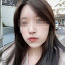 닥터쁘띠의원마곡점 | 비아프의원 입술필러, 입꼬리 보톡스 내돈내산 후기