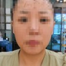 디자인엠&씨크릿인모가발 | 대구 항암가발 후기 뷰티리움&씨크릿 인모가발