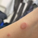 에스비피부과의원 이미지