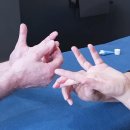 손가락이 점점 굽어진다면? 듀피트렌 구축 마사지·스트레칭 접근법. 이미지