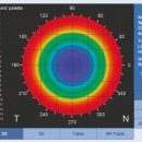 자이스안경 이미지