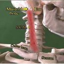 사경[斜頸, torticollis] 이미지