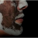 우리피부 이미지