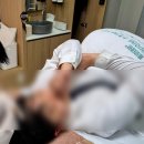 잠실나루나들목 앞 | 잠실나루피부과 줄기세포 두피주사로 탈모예방 내돈내산 후기