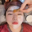 부산영천손한의원 | 부산쥐젖제거 서면편평사마귀제거 전문 부산편평사마귀제거한의원 솔직 방문 후기