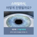 스마일 | 스마일라식후기 살펴보고 결정하는 게 좋은 이유