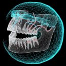 서울미소드림치과의원 | 강남 미소드림치과 안면비대칭 교정의 해답