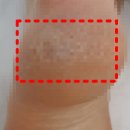 세린한의원 | 발꿈치각질제거 아이템 후기 (+연고 추천)