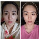 약손명가 인천검단신도시점 맞춤관리B 5회 중간점검 후기
