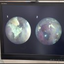 행복히어링 이미지