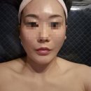 수피아에스테틱 | [수피아스킨앤바디]세종시 조치원 모공관리 후기, 조치원 피부관리 추천