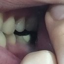 남문튼튼치과의원 | 용산 치과 추천 효창공원앞역 "튼튼한 치과의원" 어금니 신경치료 하고 온 후기