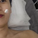 창원피부관리 신월동 엘그로우뷰티에서 LDM 물방울 리프팅 받은 후기