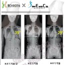 보조기전