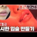 입술필러 없이 윗입술 볼륨을 만들 수 있을까? (세모입술+입꼬리교정 수술 전) 이미지