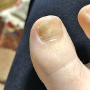 라벤더약국 | 약국 풀케어 발톱무좀약 꼬릿한 발톱 냄새 잡는법