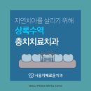 상록수역충치치료치과 자연치아를 살리기 위해