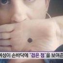 블랙닷(black_dot) 이미지