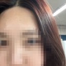 류헤어라인 이미지