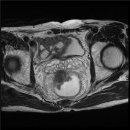 한국대장암예방센터 이미지