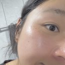 민감성 피부 고민 끝! 아씬(ACCINE) 안티 트러블 클렌징 폼으로 딥 클렌징하는 법