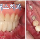 리더스 치과기공소 이미지