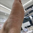 경기도 수원시 권선구 덕영대로1142번길 23-17 (세류동) | 수원 세류동 발각질 추천받고찾은 전문 관리샵 코지네일 오벨리네일푸스 족보있는그녀들 수원역점