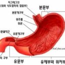 위암자연치료사례 이미지